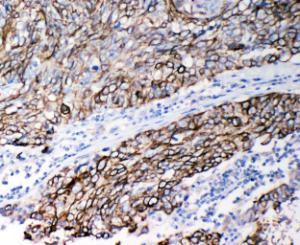 Anti-Stefin B Rabbit Polyclonal Antibody