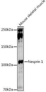 Western blot analysis of extracts of Mouse skeletal muscle, using Anti-Nesprin1/Syne-1 Antibody (A306171) at 1:1,000 dilution