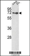 Anti-KLF4 Rabbit Polyclonal Antibody