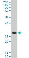 Anti-DNAJB6 Mouse Polyclonal Antibody