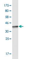 Anti-KDM6A Mouse Monoclonal Antibody [clone: 4E7]