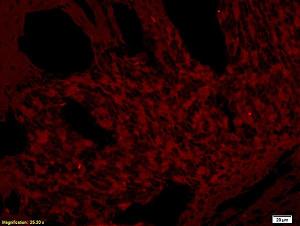 Anti-BTLA Rabbit Polyclonal Antibody