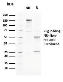 SDS-PAGE analysis of Anti-PAPP A Antibody [PAPPA/2715] under non-reduced and reduced conditions; showing intact IgG and intact heavy and light chains, respectively. SDS-PAGE analysis confirms the integrity and purity of the antibody