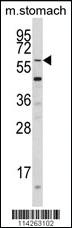 Anti-KLF4 Rabbit Polyclonal Antibody