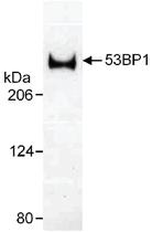 Anti-TP53BP1 Rabbit Polyclonal Antibody