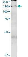 Anti-TBC1D1 Polyclonal Antibody Pair