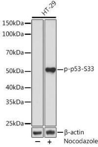 Western blot analysis of extracts of HT-29 cells, using Anti-p53 (phospho Ser33) Antibody [ARC1528] (A309081) at 1:1,000 dilution