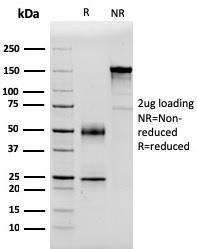 SDS-PAGE analysis of Anti-Serum Amyloid P Antibody [APCS/3240] under non-reduced and reduced conditions; showing intact IgG and intact heavy and light chains, respectively. SDS-PAGE analysis confirms the integrity and purity of the Antibody