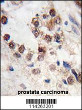 Anti-KLF4 Rabbit Polyclonal Antibody