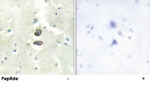 Anti-BRI3BP Rabbit Polyclonal Antibody