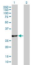 Anti-VAPB Rabbit Polyclonal Antibody