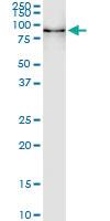 Anti-POGK Polyclonal Antibody Pair