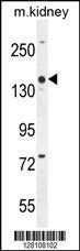 Anti-COBL Rabbit Polyclonal Antibody (AP (Alkaline Phosphatase))