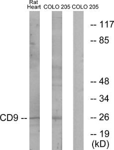 Western blot analysis of lysates from rat heart and COLO cells using Anti-CD9 Antibody. The right hand lane represents a negative control, where the antibody is blocked by the immunising peptide