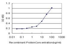 Anti-MAP2K6 Mouse Monoclonal Antibody [clone: 2F2]