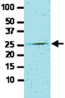 Anti-FADD Mouse Monoclonal Antibody [clone: J1D2]