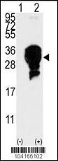 Anti-E2EPF Rabbit Polyclonal Antibody (PE (Phycoerythrin))