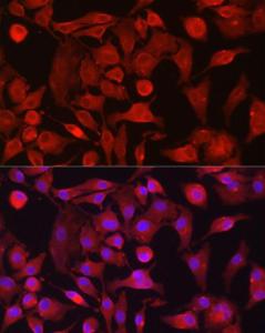 Immunofluorescence analysis of A-549 cells using Anti-RASGRP1 Antibody (A8633) at a dilution of 1:100 (40X lens). DAPI was used to stain the cell nuclei (blue)