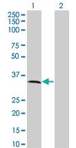 Anti-MPPED2 Mouse Monoclonal Antibody [clone: 2G1-1B7]