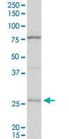 Anti-DNAJB6 Mouse Polyclonal Antibody