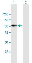 Anti-ARHGAP12 Mouse Polyclonal Antibody