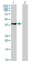 Anti-BBS5 Mouse Polyclonal Antibody