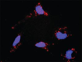 Anti-TP53 + DAXX Antibody Pair