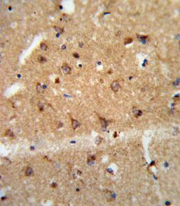 Anti-Glial Derived Neurotrophic Factor Rabbit Polyclonal Antibody (AP (Alkaline Phosphatase))