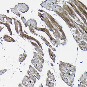 Immunohistochemistry analysis of paraffin-embedded rat heart using Anti-Nesprin1/Syne-1 Antibody (A306171) at a dilution of 1:100 (40X lens). Perform high pressure antigen retrieval with 10 mM citrate buffer pH 6.0 before commencing with IHC staining protocol