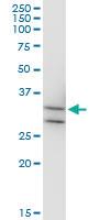 Anti-MPPED2 Mouse Monoclonal Antibody [clone: 4H5]