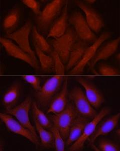 Immunofluorescence analysis of U2OS cells using Anti-JNK1 + JNK2 + JNK3 Antibody (A307842) at a dilution of 1:100 (40X lens). DAPI was used to stain the cell nuclei (blue)