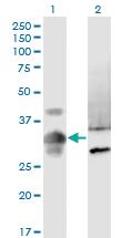 Anti-MPPED2 Mouse Monoclonal Antibody [clone: 4H5]