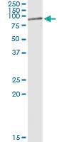 Anti-RIOK2 Rabbit Polyclonal Antibody