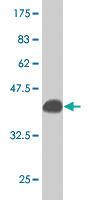 Anti-APOM Mouse Monoclonal Antibody [clone: 2A8]