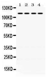 Anti-NR3C2 Rabbit Polyclonal Antibody