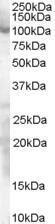 Anti-SP1 antibody