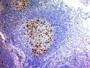 Immunohistochemical analysis of formalin-fixed, paraffin-embedded human tonsil using Anti-CD57 Antibody [NK/804]