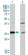 Anti-DNAJB6 Mouse Polyclonal Antibody