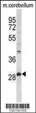 Anti-PPT1 Rabbit Polyclonal Antibody (PE (Phycoerythrin))