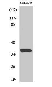 Anti-OR52B2 Rabbit Polyclonal Antibody