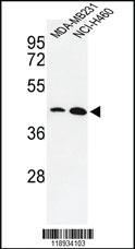 Anti-KLF4 Rabbit Polyclonal Antibody