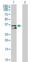 Anti-UNG Mouse Polyclonal Antibody