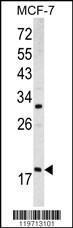 Anti-ARF3 Rabbit Polyclonal Antibody