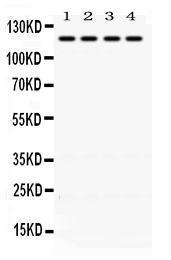 Anti-OGT Rabbit Polyclonal Antibody