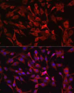 Immunofluorescence analysis of C6 cells using Anti-RASGRP1 Antibody (A8633) at a dilution of 1:100 (40X lens). DAPI was used to stain the cell nuclei (blue)