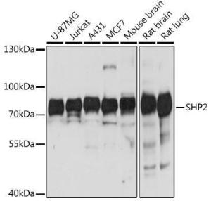 Western blot analysis of extracts of various cell lines, using Anti-SHP2 Antibody (A93012) at 1:1000 dilution. The secondary Antibody was Goat Anti-Rabbit IgG H&L Antibody (HRP) at 1:10000 dilution. Lysates/proteins were present at 25 µg per lane