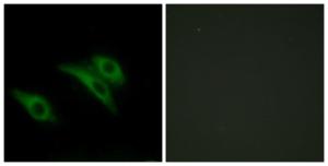 Immunofluorescence analysis of HeLa cells using Anti-CD9 Antibody. The right hand panel represents a negative control, where the antibody was pre-incubated with the immunising peptide