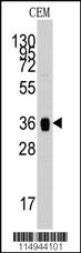 Anti-ALDOA Rabbit Polyclonal Antibody