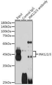 Immunoprecipitation analysis of 600 µg extracts of mouse brain cells using 3 µg of Anti-JNK1 + JNK2 + JNK3 Antibody (A307842). This Western blot was performed on the immunoprecipitate using Anti-JNK1 + JNK2 + JNK3 Antibody (A307842) at a dilution of 1:1000