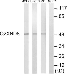 Anti-Cytochrome P450 2D6 Rabbit Polyclonal Antibody